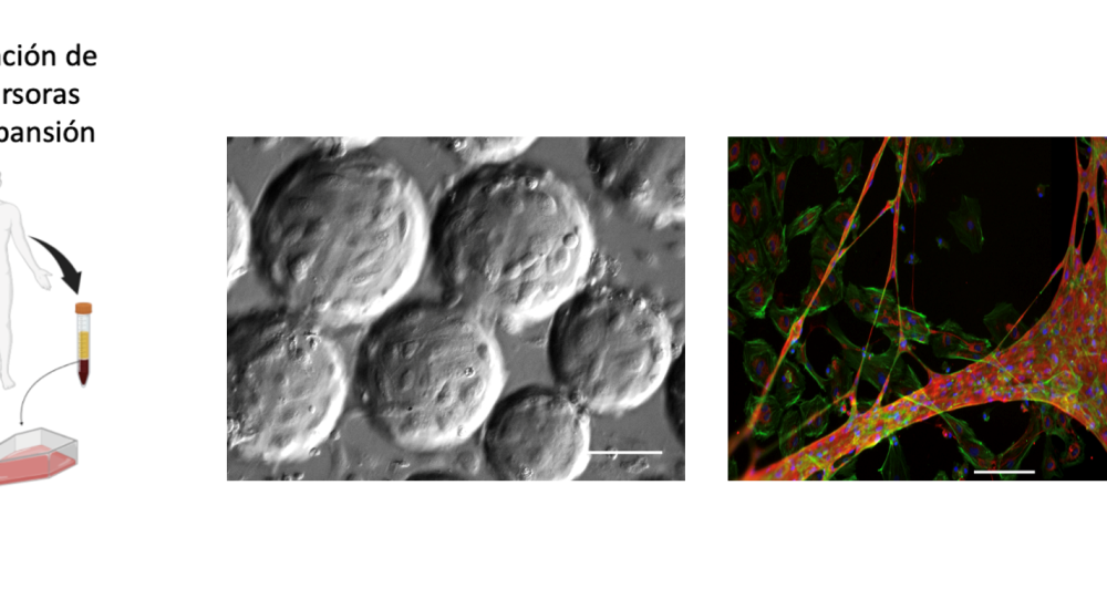 Bioprocesos de células progenitoras endoteliales humanas: derivación, expansión, especialización, y futuras aplicaciones terapéuticas