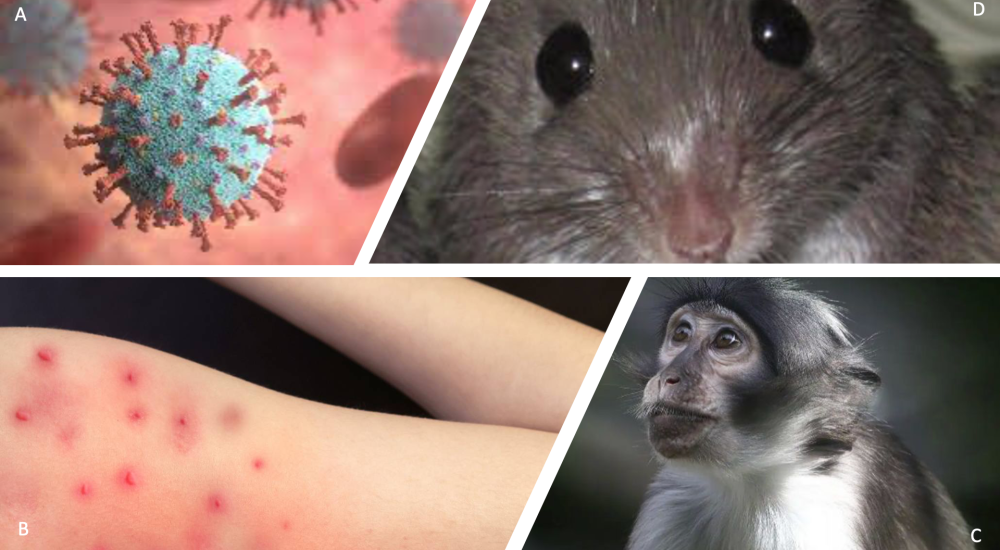 La viruela del mono llegó a México ¡conoce como puedes prevenirla!