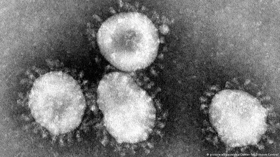 Figura 1.- Imagen de partículas de Coronavirus en un microscopio electrónico. El nombre se deriva de la similitud del virus visto al microscopio electrónico con una corona. Tomadas de https://sp.depositphotos.com/stock-photos/coronas-de-rey.html y https://www.dw.com/es/coronavirus-c%C3%B3mo-se-contagia-y-se-puede-prevenir/a-52101965