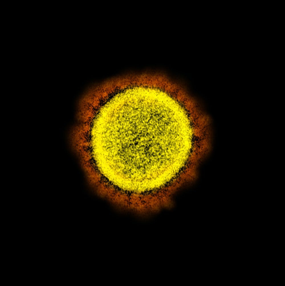 Figura 6. Microfotografía de transmisión de partículas del virus del SARS-CoV-2, aislada de un paciente. Tomada de: https://theconversation.com/esto-es-lo-que-los-virologos-sabemos-hasta-hoy-sobre-el-coronavirus-sars-cov-2-137274