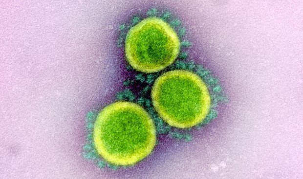 Figura 5. Micrografía tomada con microscopio de transmisión de electrones de los virus SARS-CoV2, aislados de un paciente. Imagen capturada y con colores más vivos en NIAID Integrated Reserch Facility (IRF) en Fort Detrick, Marylanda. Tomada de: https://es.wikipedia.org/wiki/SARS-CoV-2