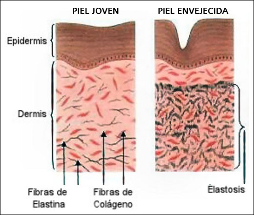 Figura2. Representación del proceso de envejecimiento en la piel. Figura tomada de http://www.cosmetologas.com/noticias/val/2283-52/cómo-afecta-el-envejecimiento-a-cada-capa-de-la-piel-.html.